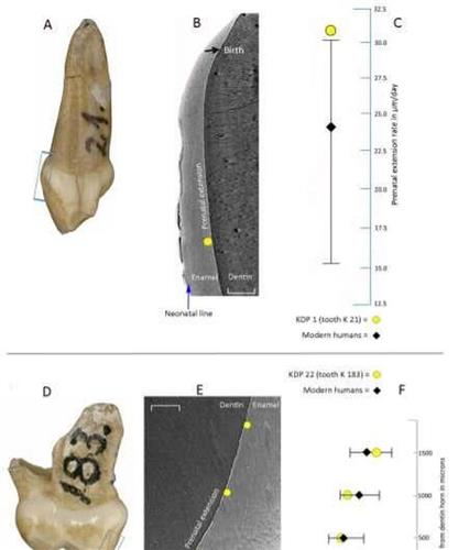 Các mẩu răng cửa của đứa trẻ Neanderthals cho thấy nó phát triển sớm hơn răng cửa của trẻ em thuộc loài chúng ta đến 4 tháng - Ảnh: Proceedings of The Royal Society B